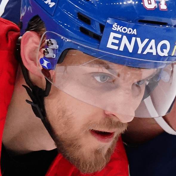 Čeští hokejisté dostali v minulém utkání pořádnou facku